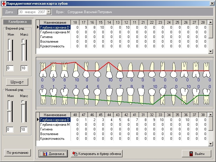 Заполнение пародонтологической карты зубов в DentExpert